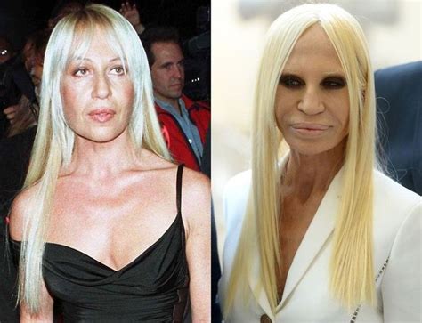 photo donatella versace|donna versace before surgery.